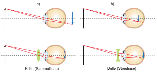 ././Physikkurs/geometrischeoptik_linsenabbildungen/images/Brille.png